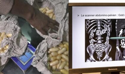 Pour financer ses soins : elle avale 100 boulettes de cocaïne